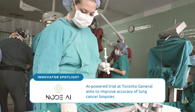 NodeAI: AI-powered trial at Toronto General aims to improve accuracy of lung cancer biopsies