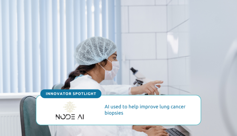 AI used to help improve lung cancer biopsies