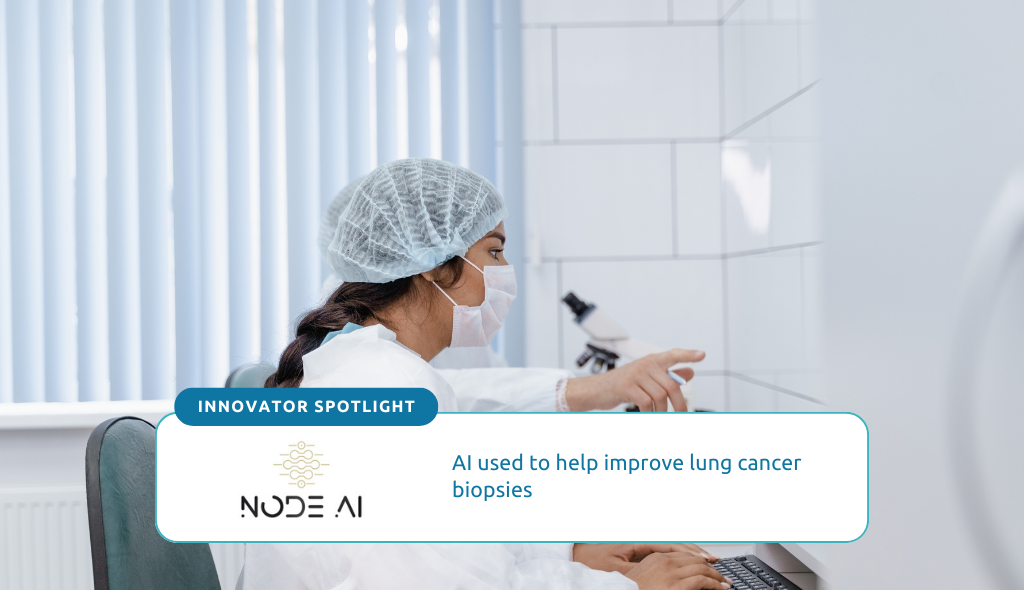 AI used to help improve lung cancer biopsies